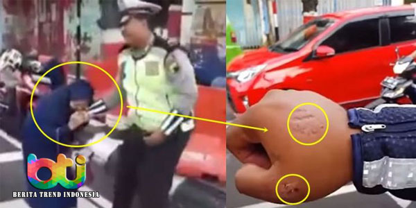 tak-terima-di-tilang-seorang-polisi-di-gigit-emak-emak