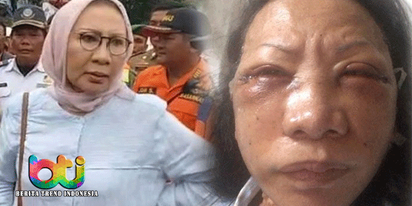 Medsos-Heboh-Ratna-Sarumpaet-Dianiaya-Sampai-Babak-Belur