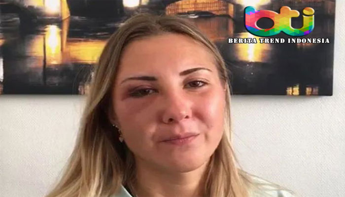 Home Global Wanita Ini Dipukul oleh 3 Pria karena Pakai Rok