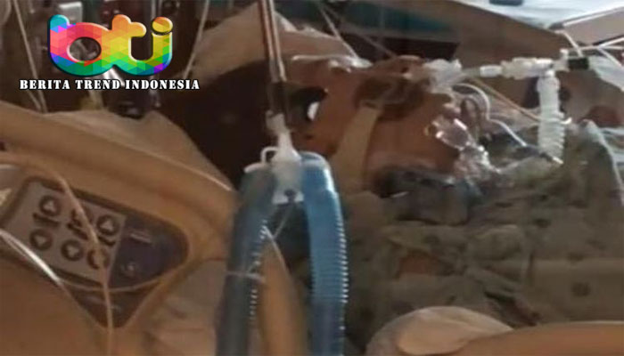 Berbulan-bulan Tidak Ganti Masker, Dokter Muda Meninggal karena Pendarahan Otak